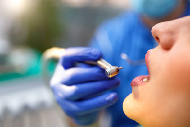 Best Dental Fillings (Composite and Amalgam)  in Tangent, OR
